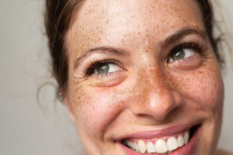 getty freckles smiling happy closeup