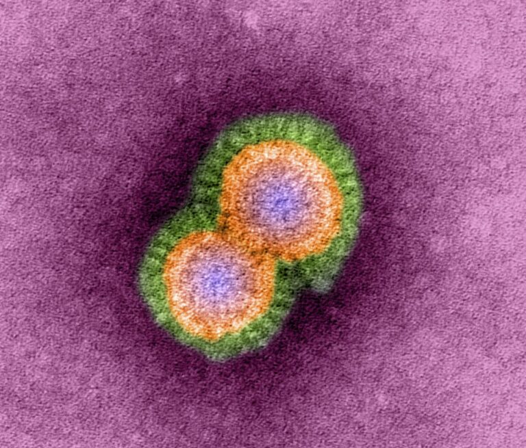 H5N1 virus